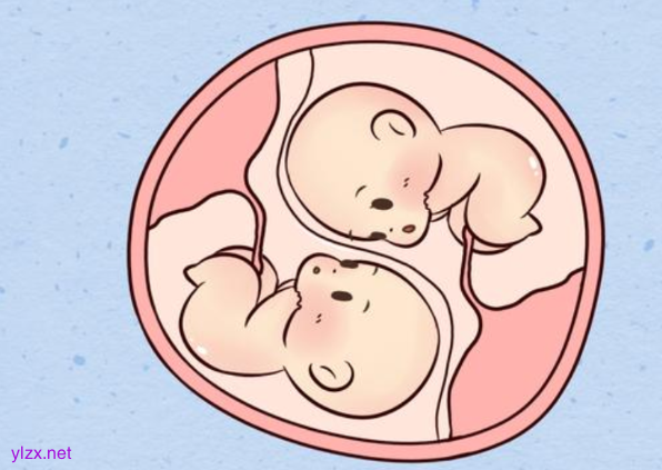 双胞胎在子宫内斗争出生后一红一白，原因究竟是何?