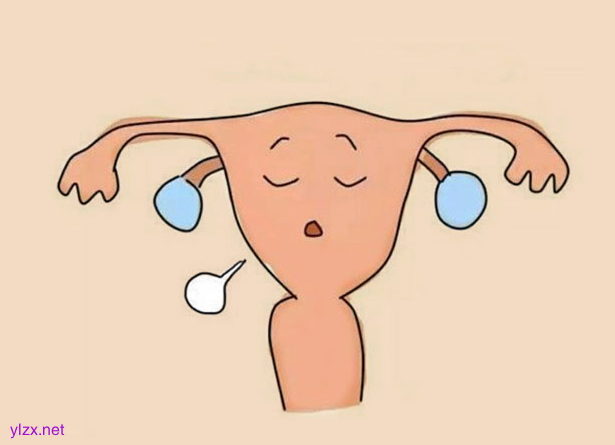 幼稚型子宫能治好吗?得了幼稚子宫就会不孕吗? 幼稚型子宫能治好吗?得了幼稚子宫就会不孕吗?